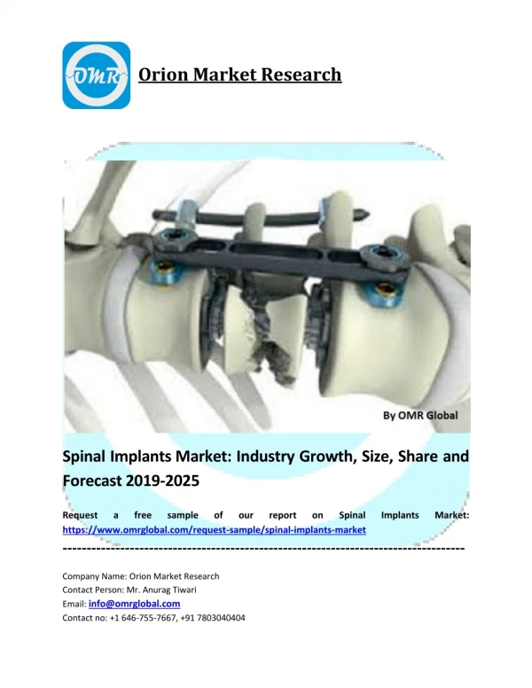 Spinal Implants Market Size, Share, Analysis Report, Research and Forecast 2019-2025
