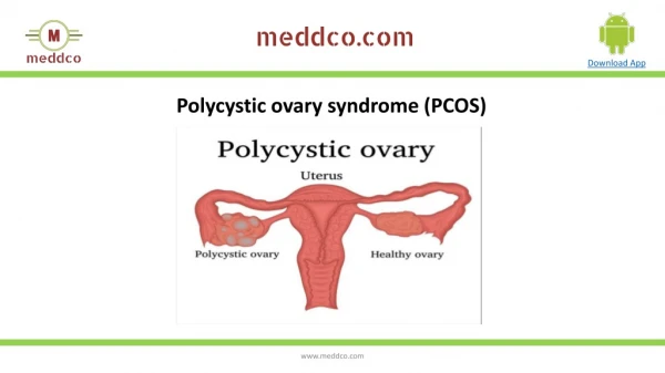 Polycystic ovary syndrome (PCOS)| Meddco