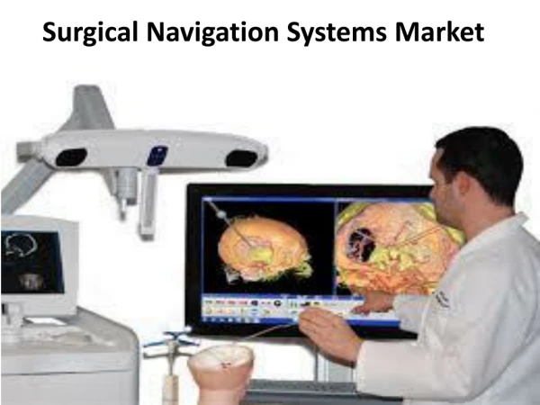 Global Surgical Navigation Systems Market Expected to Reach $963 Million, Globally, by 2022