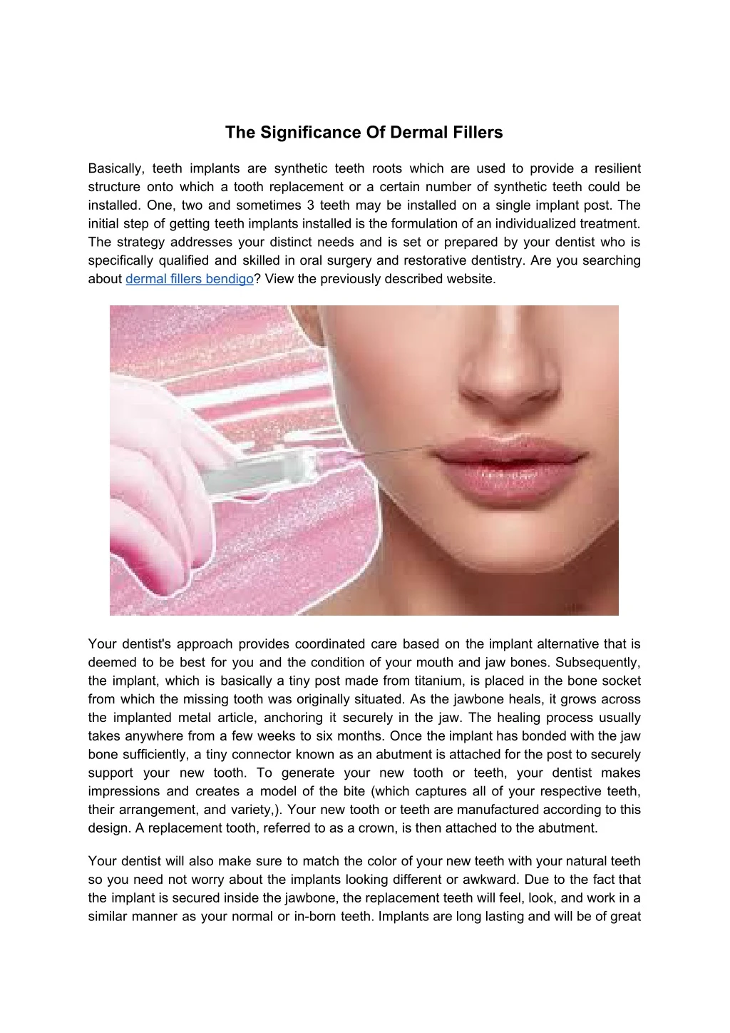 the significance of dermal fillers