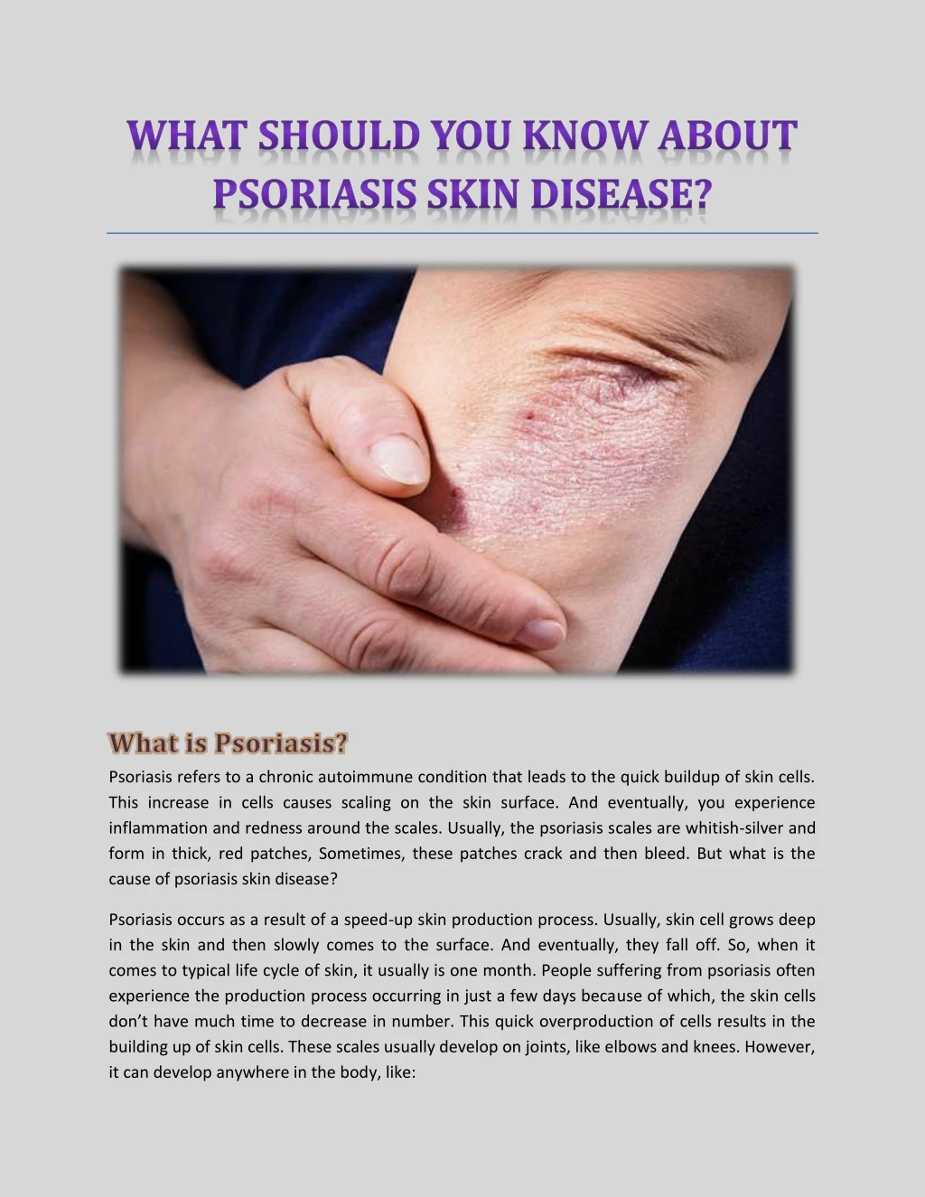 psoriasis refers to a chronic autoimmune