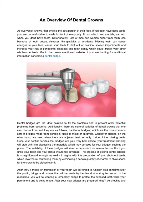 An Overview Of Dental Crowns