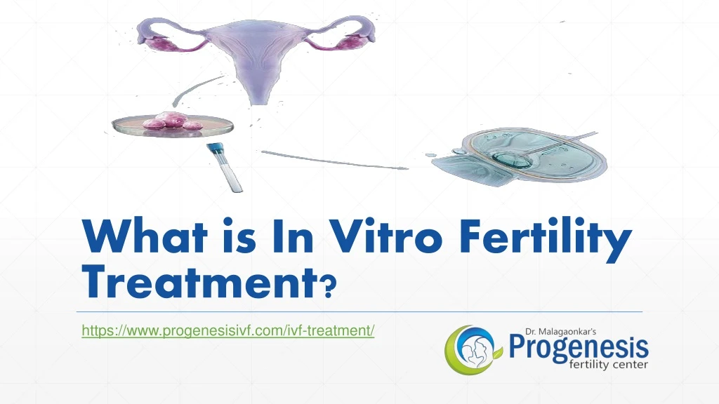 what is in vitro fertility treatment