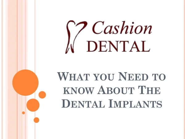 What you Need to know About The Dental Implants