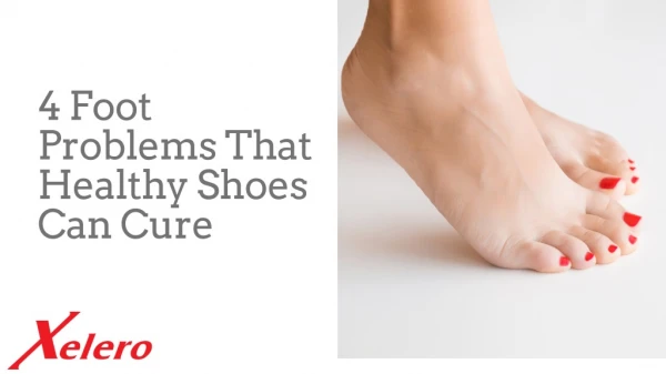 4 Foot Problems That Healthy Shoes Can Cure