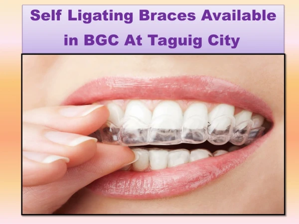 Self Ligating Braces Available in BGC at Taguig