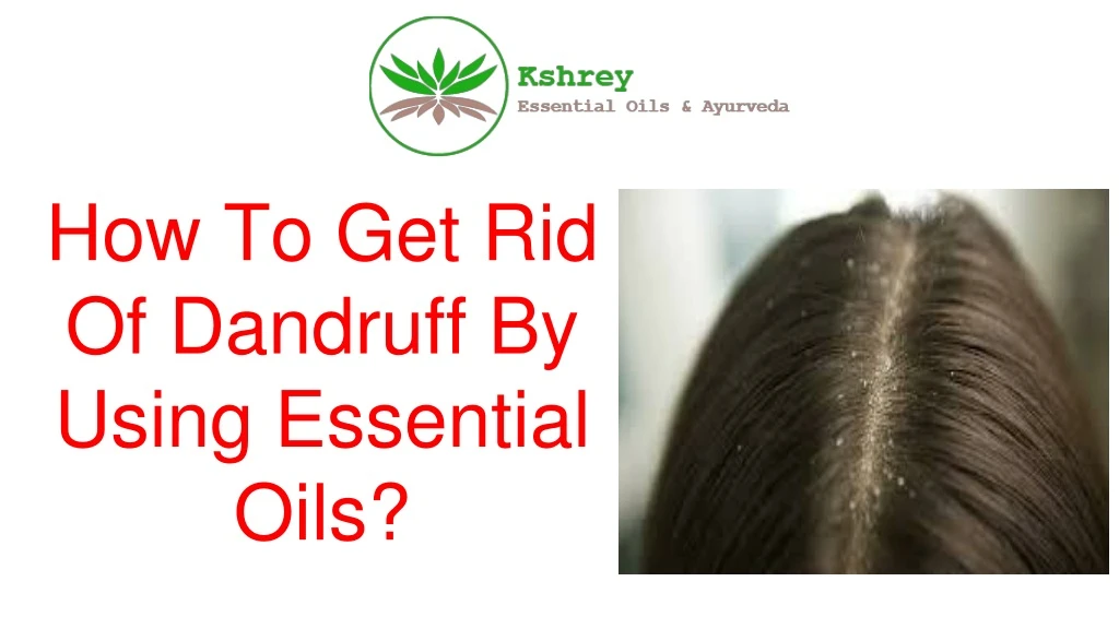 how to get rid of dandruff by using essential oils