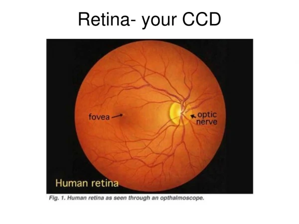 Retina- your CCD