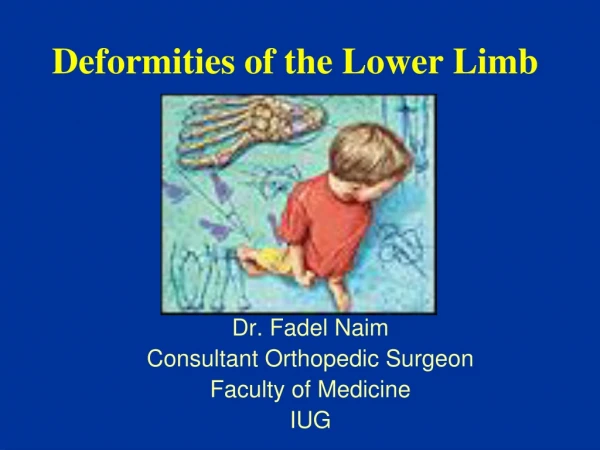 Deformities of the Lower Limb