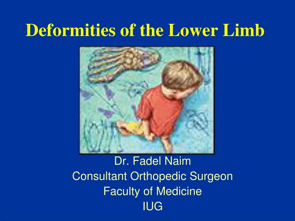 deformities of the lower limb