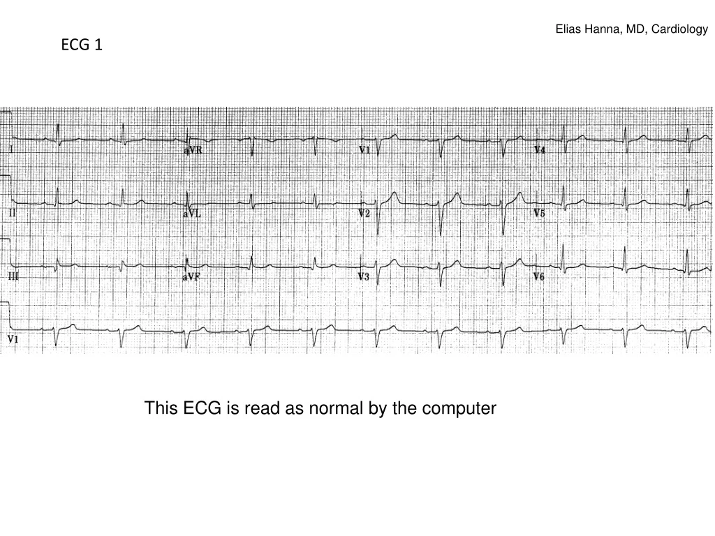 elias hanna md cardiology