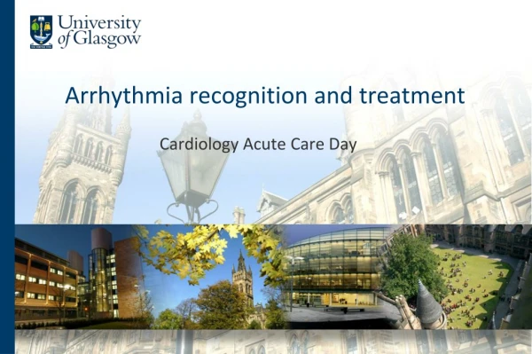 Arrhythmia recognition and treatment