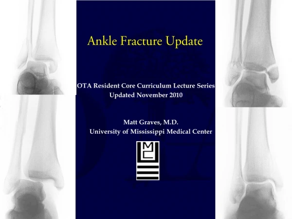 Ankle Fracture Update