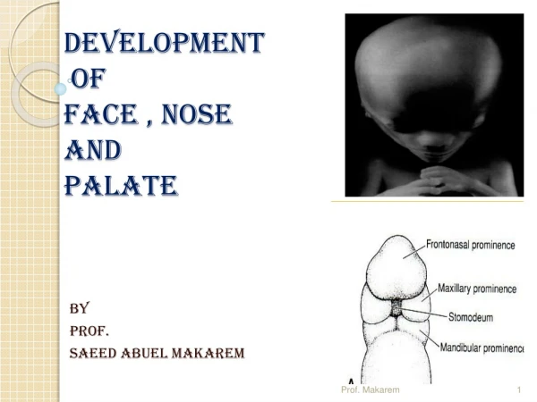 DEVELOPMENT  OF  FACE , NOSE  AND  PALATE