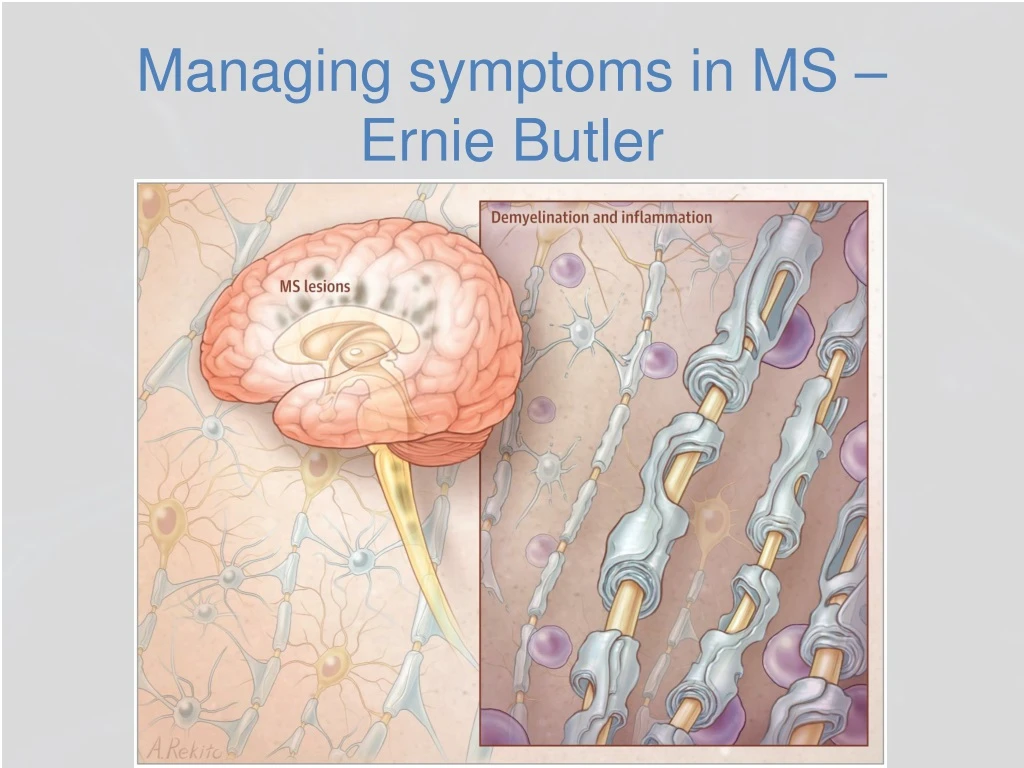 managing symptoms in ms ernie butler