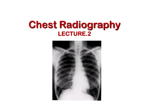 Chest Radiography LECTURE.2