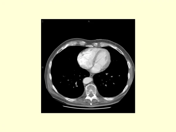 What is this contrast containing structure posterior to the liver?