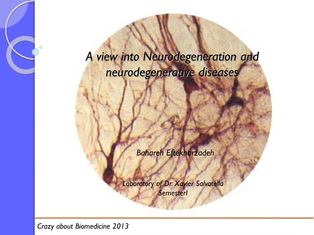 a view into neurodegeneration