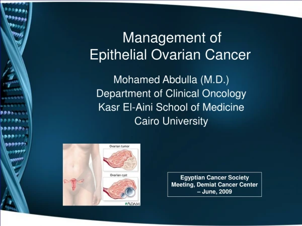 Management of  Epithelial Ovarian Cancer