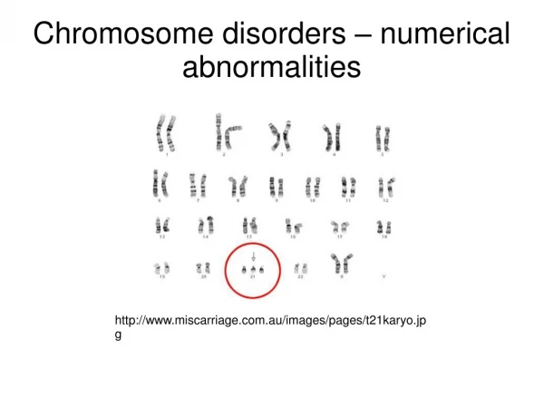Chromosome disorders – numerical abnormalities