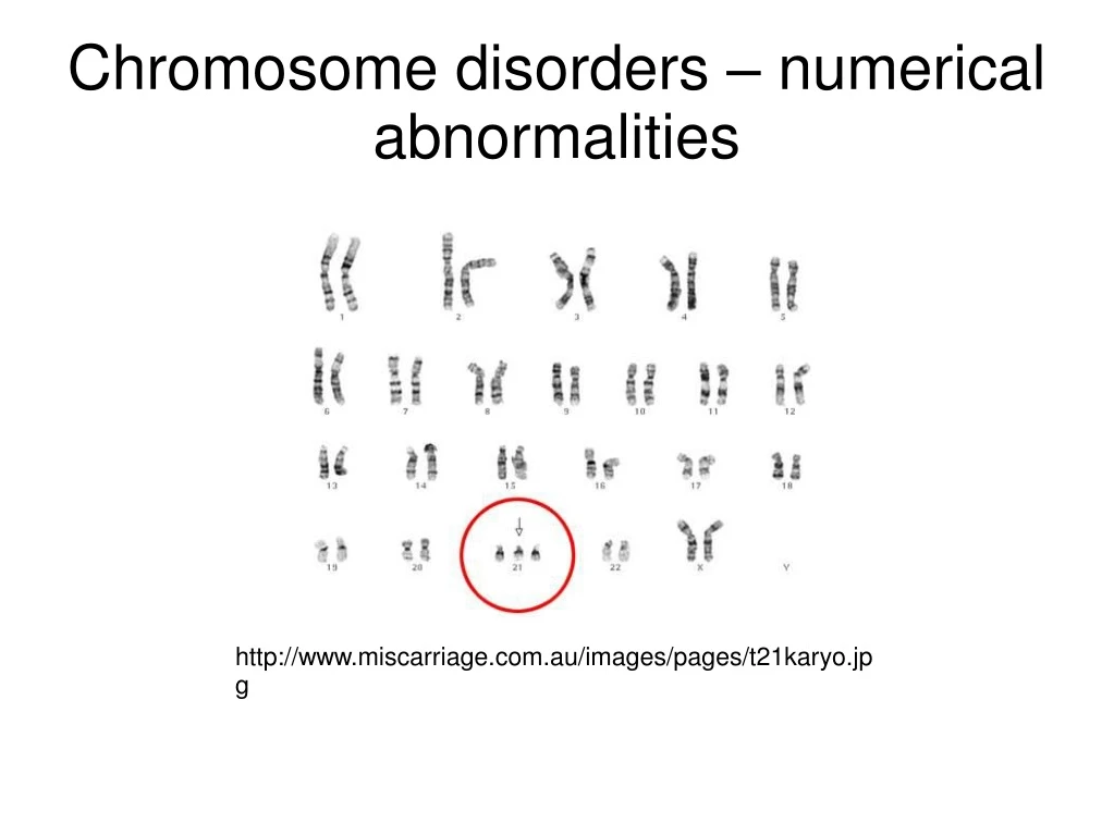 chromosome disorders numerical abnormalities