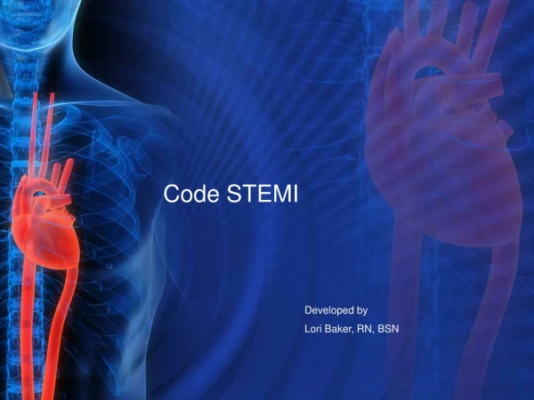 Code STEMI