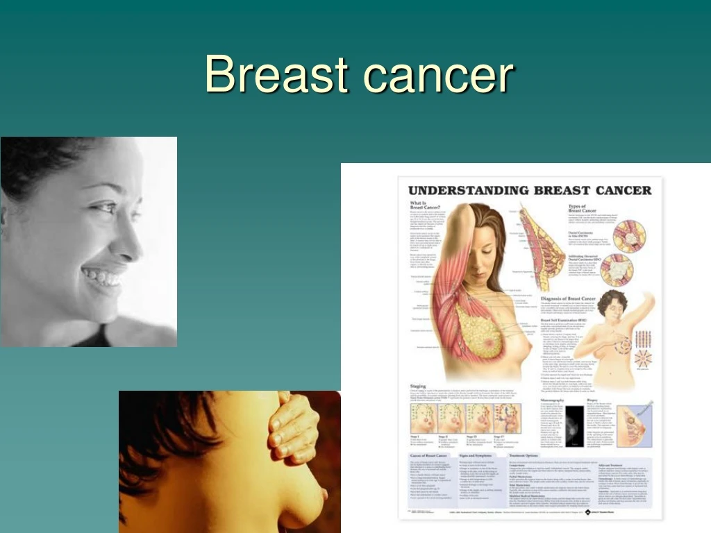 breast cancer