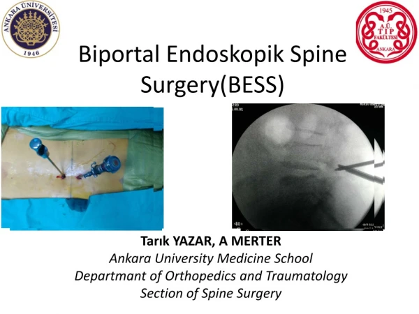 Biportal Endoskopik Spine Surgery(BESS)
