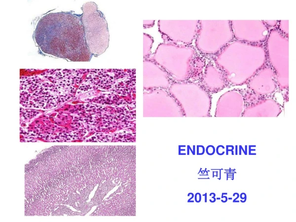 ENDOCRINE 竺可青  2013-5-29