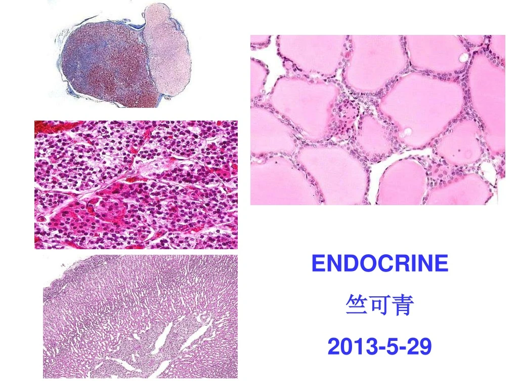 endocrine 2013 5 29