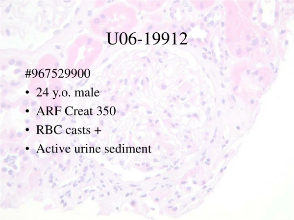 U06- 19912