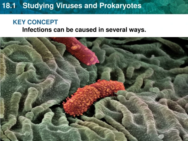 KEY CONCEPT Infections can be caused in several ways.