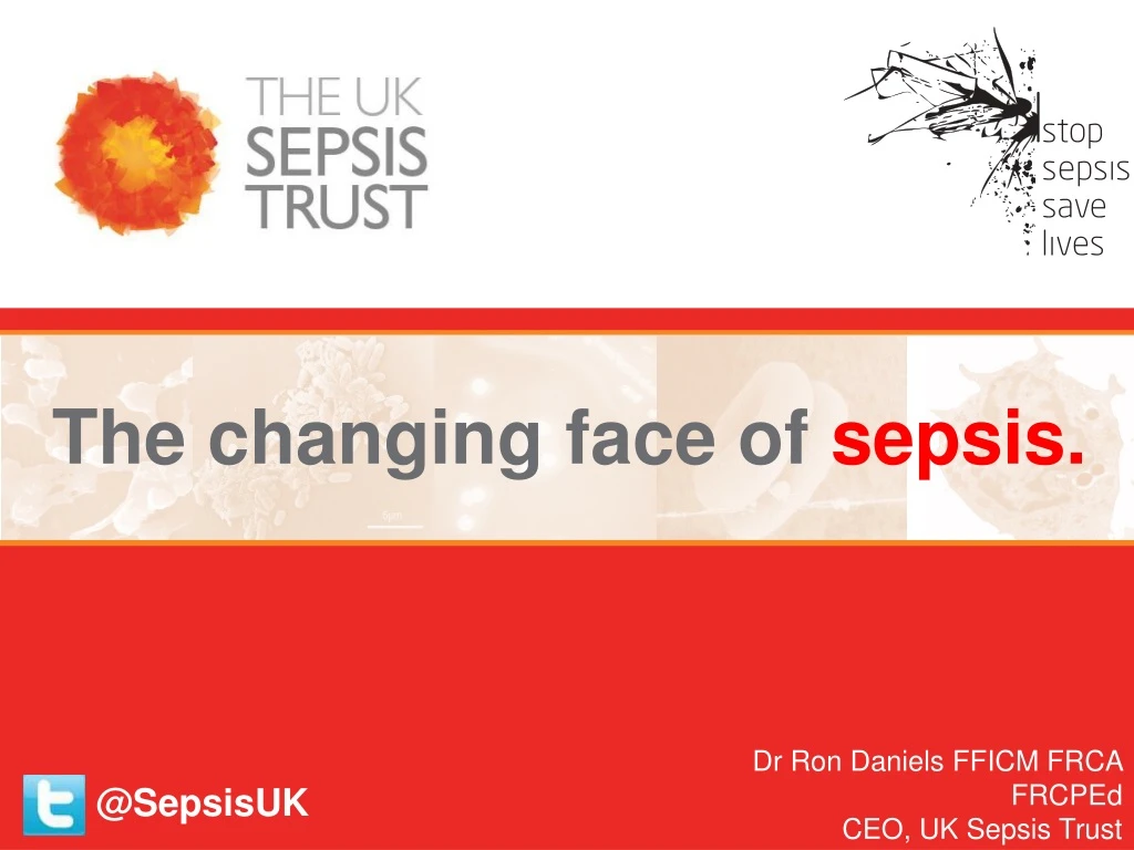 the changing face of sepsis