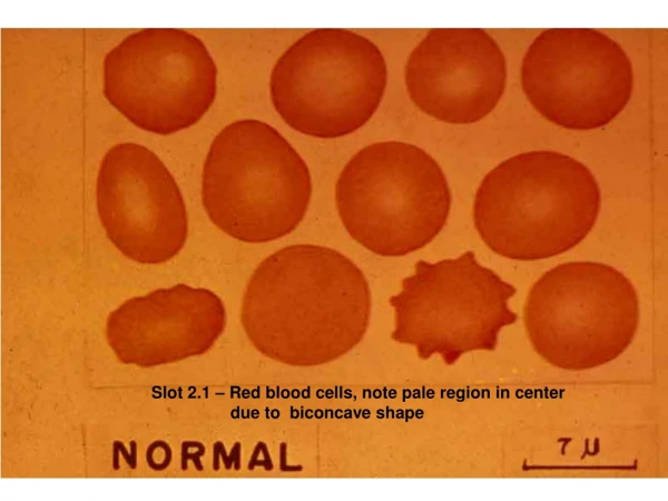 Slot 2.1 – Red blood cells, note pale region in center                   due to  biconcave shape