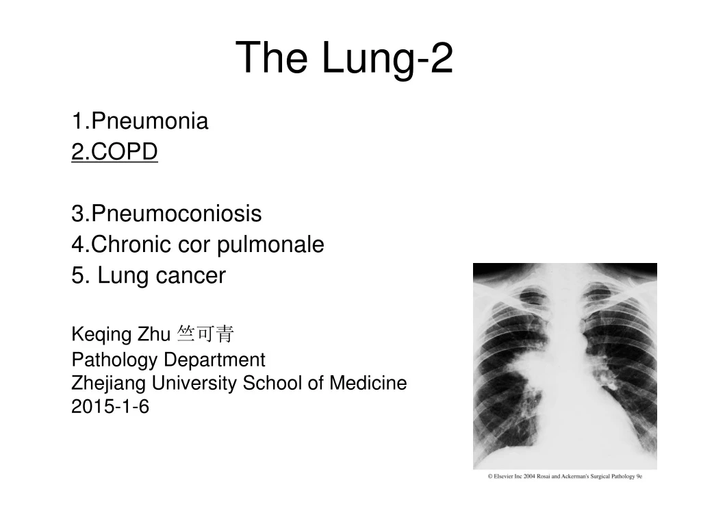 the lung 2
