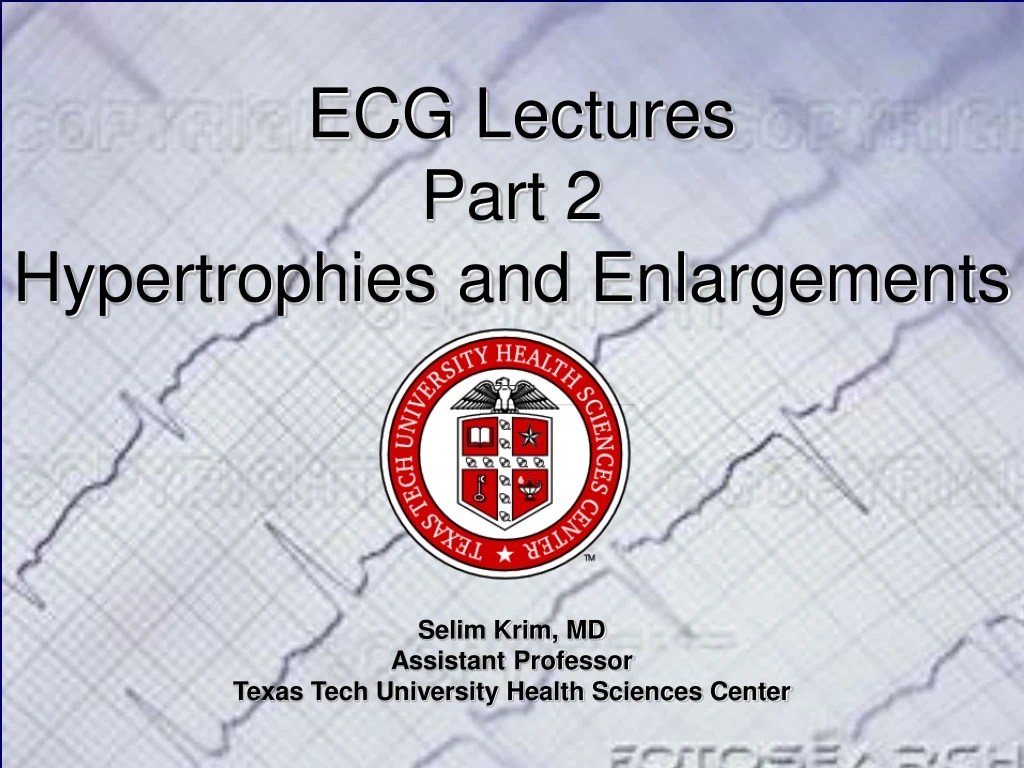 ecg lectures part 2 hypertrophies