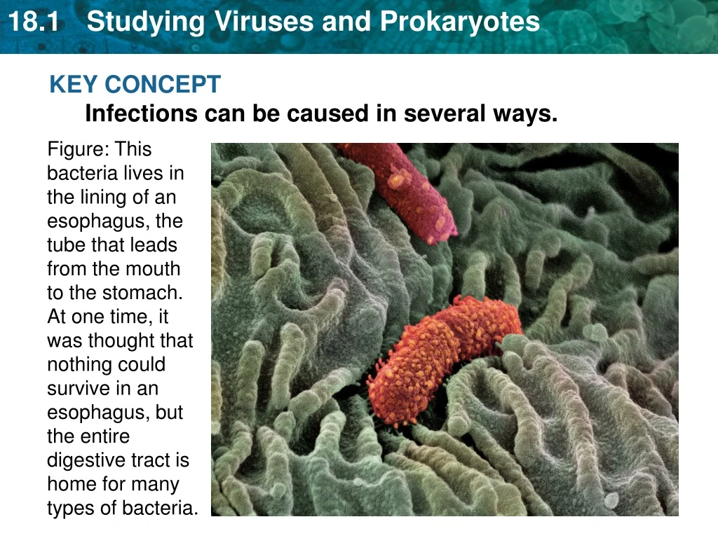 key concept infections can be caused in several