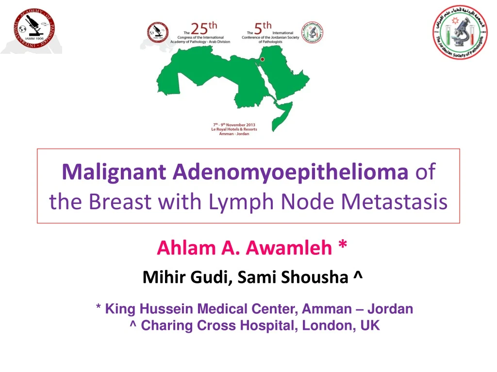 malignant adenomyoepithelioma of the breast with lymph node metastasis