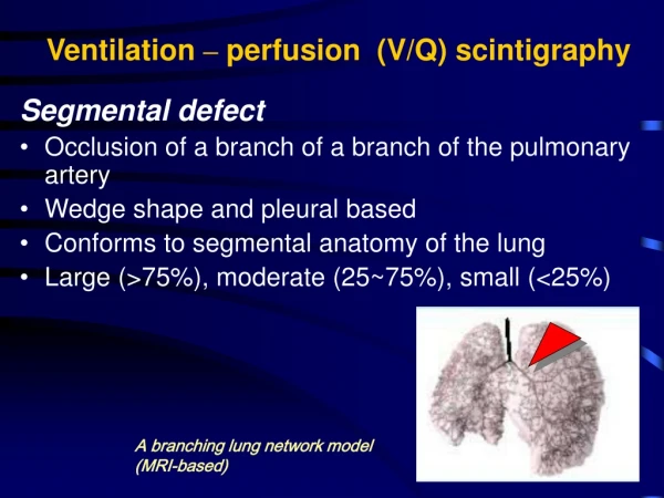 Ventilation  –  perfusion   (V/Q)  scintigraphy