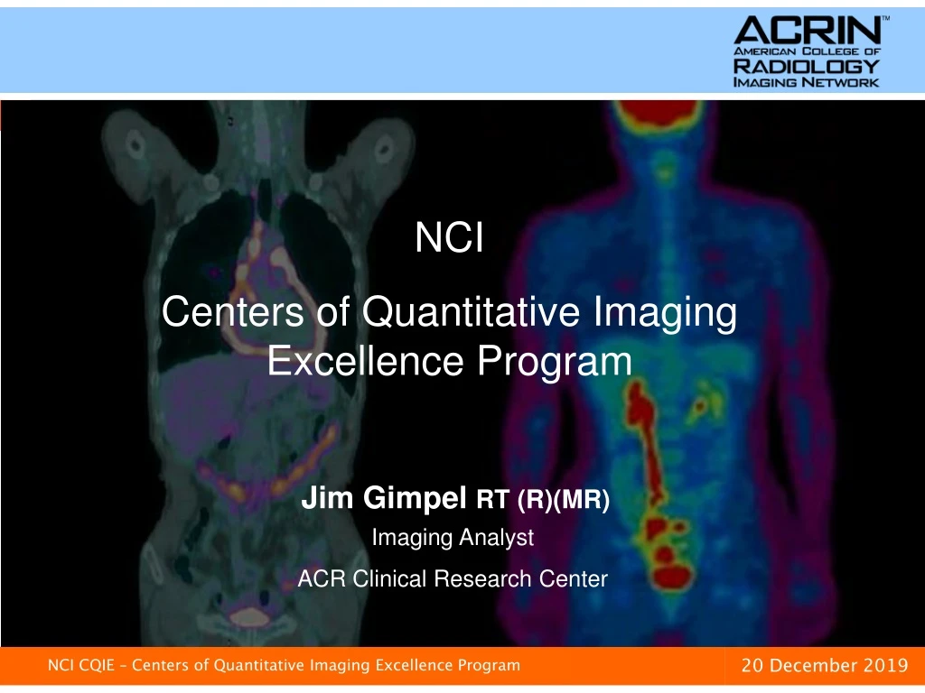 nci centers of quantitative imaging excellence