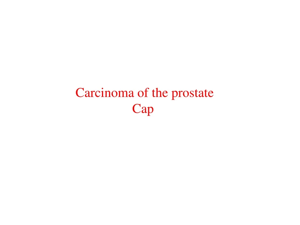 carcinoma of the prostate cap