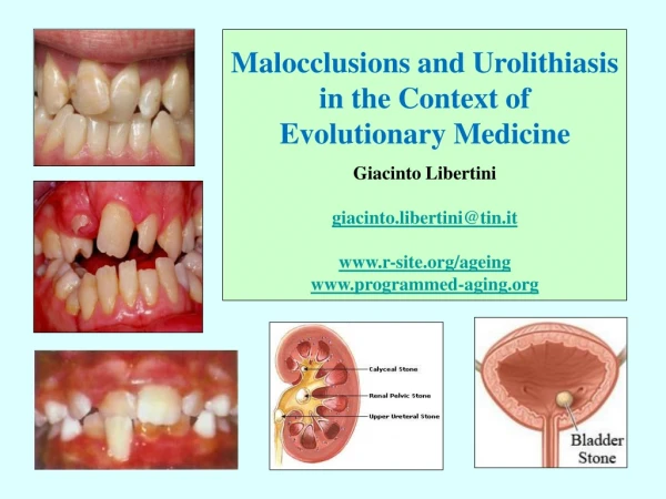 Malocclusions and Urolithiasis in the Context of Evolutionary Medicine Giacinto Libertini