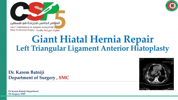 Giant Hiatal Hernia  Repair Left  Triangular Ligament Anterior  Hiatoplasty