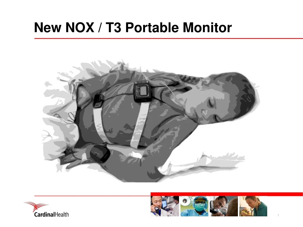 new nox t3 portable monitor