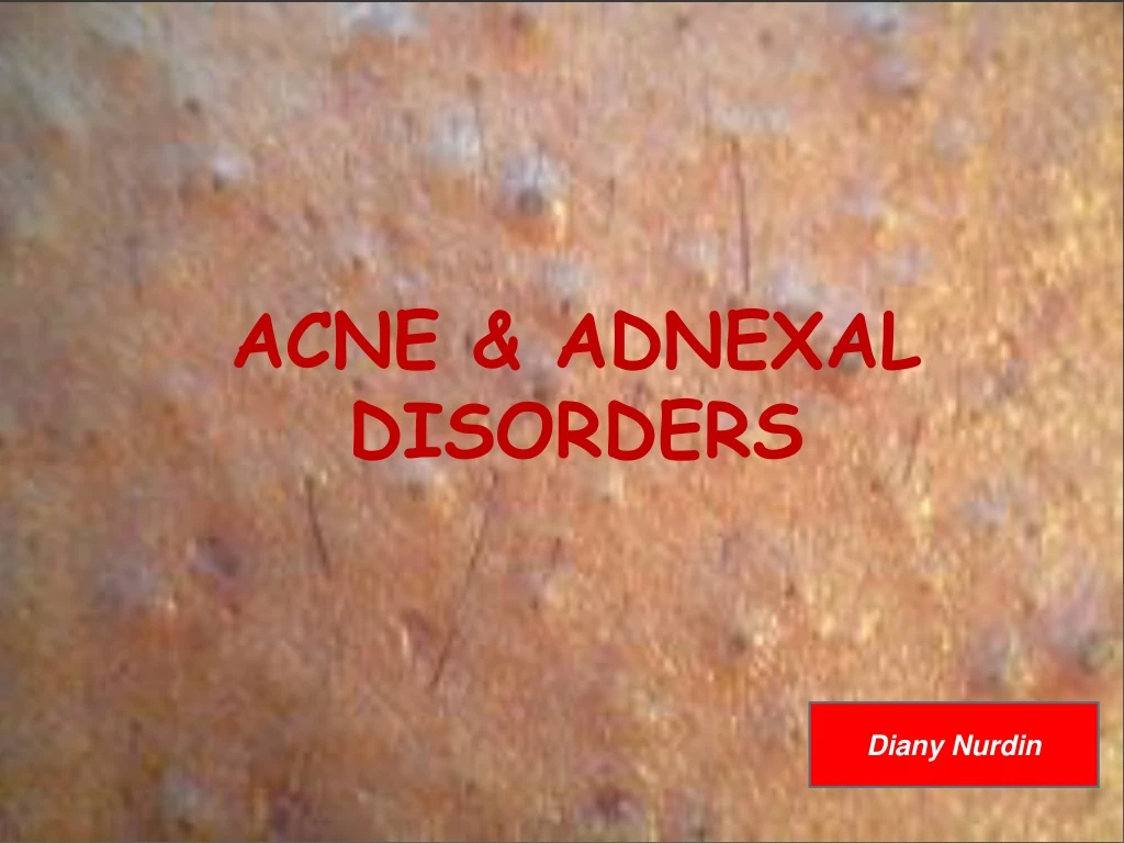 acne adnexal disorders