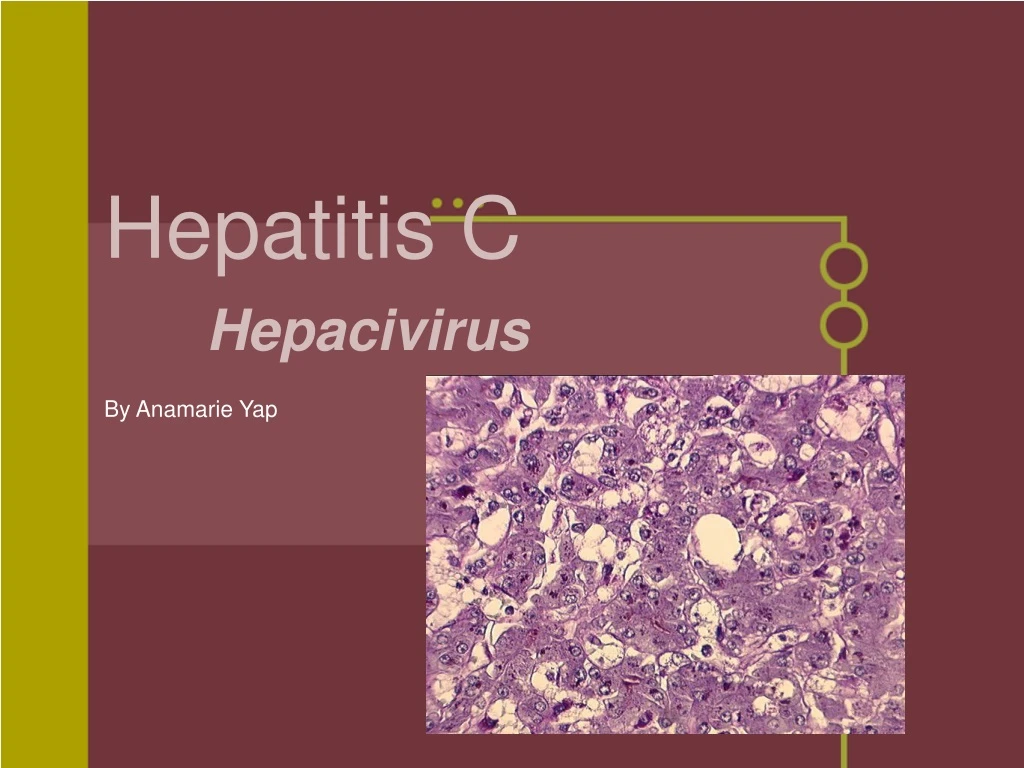 hepatitis c hepacivirus