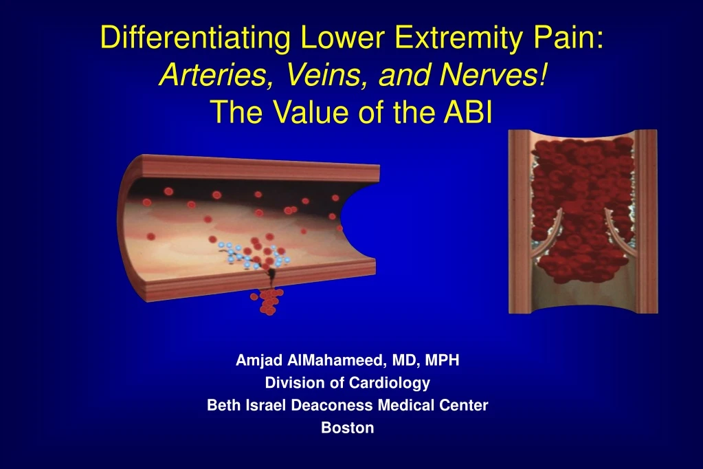 differentiating lower extremity pain arteries