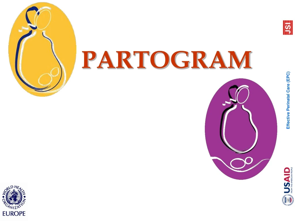 partogram