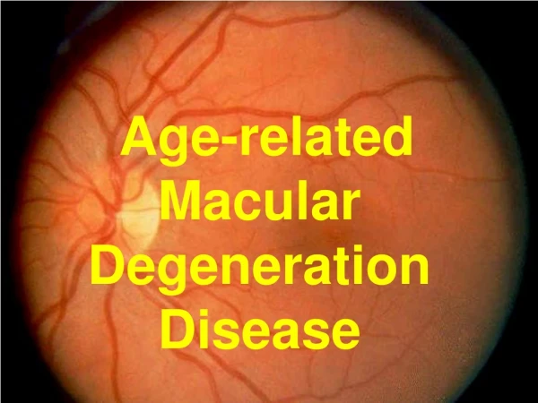 Age-related  Macular Degeneration Disease