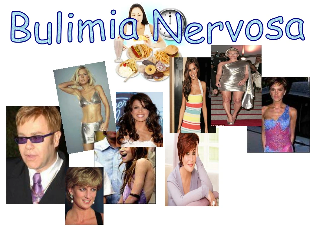 bulimia nervosa
